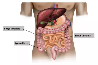 best hospital for appendix surgery in Forbesganj, best doctor for appendix treatment in Forbesganj, cost of appendix surgery in Forbesganj