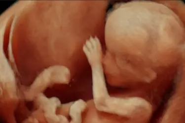 Best Ultrasound Centre in Forbesganj, Female Doctor for Ultrasound, Female Ultrasonologist in Forbesganj, TCBM Hospital Ultrasound Centre Forbesganj